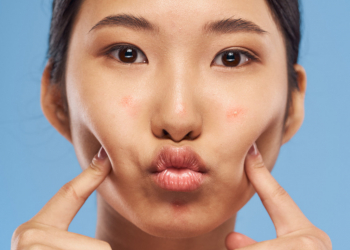 Face Mapping : comprendre vos imperfections 